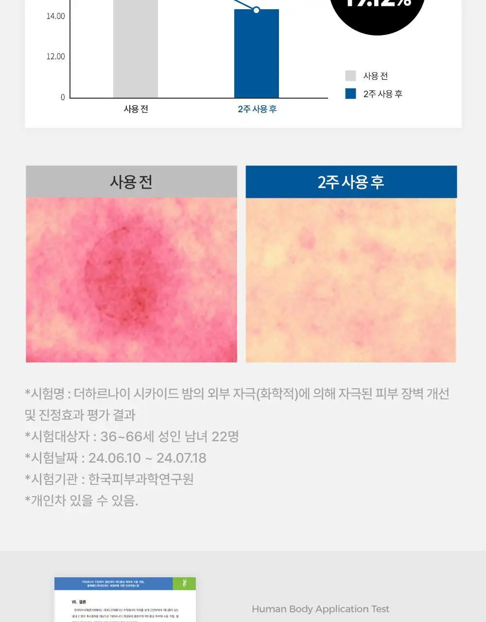 [피부장벽강화크림] 더하르나이 시카이드 밤 100ml기획(+앰플5ml*3p+크림5ml*2p) 상세페이지 8